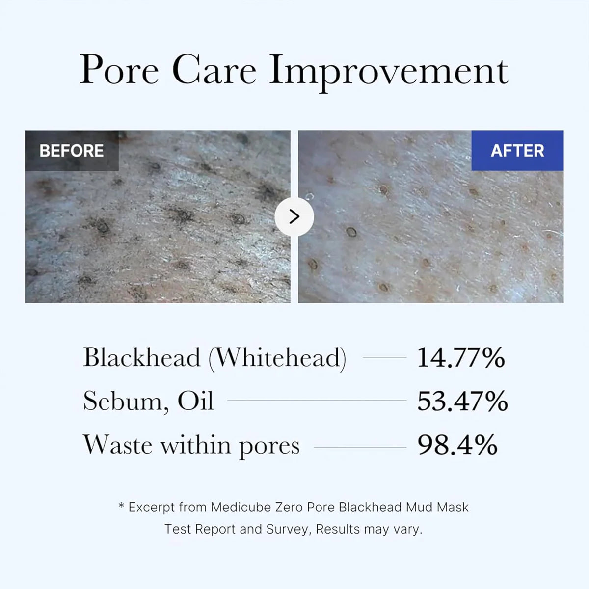 Medicube Zero Pore Blackhead Mud Mask 100g – Deep Clean & Pore Care