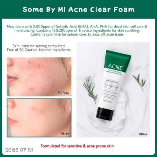 SOME BY MI AHA BHA PHA 30 Days Miracle Acne Clear Foam-100ML