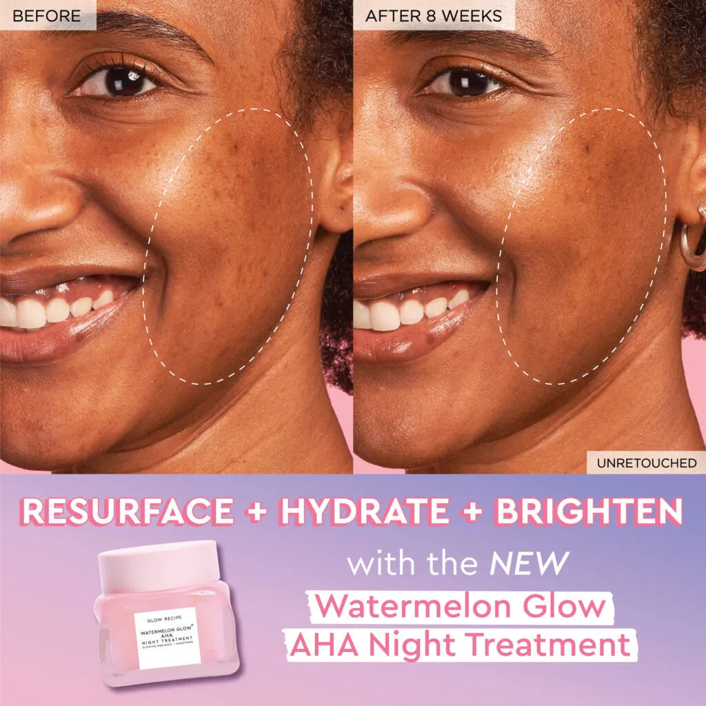 Glow Recipe Watermelon Glow AHA Night Treatment 60ml – Overnight Radiance & Hydration