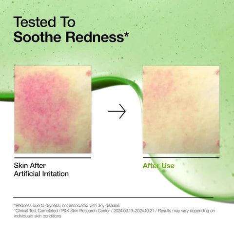 Anua Azelaic Acid 10% Hyaluron Serum - Redness Relief & Soothing - 30ml