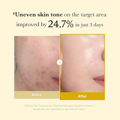 Medicube Kojic Acid Turmeric Night Wrapping Mask – 75ml | Brightening & Hydrating Overnight Treatment